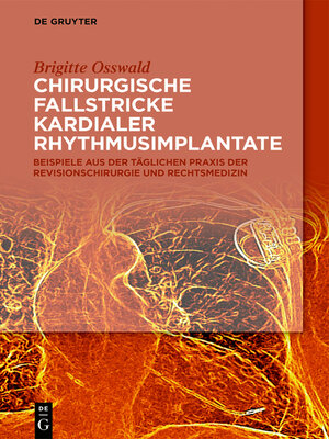 cover image of Chirurgische Fallstricke kardialer Rhythmusimplantate